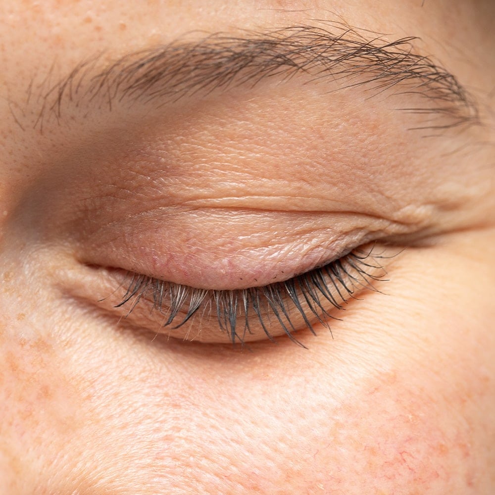 chirurgie des paupieres blepharoplastie paris dr nathalie butel chirurgien ophtalmologue specialiste chirurgie refractive cataracte oculoplastique paris chirurgie des paupieres blepharoplastie paris dr nathalie butel chirurgien ophtalmologue specialiste chirurgie refractive cataracte oculoplastique paris