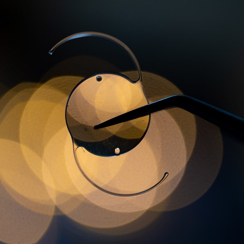 implant monofocal dr nathalie butel chirurgien ophtalmologue specialiste chirurgie refractive cataracte oculoplasticien paris implant monofocal dr nathalie butel chirurgien ophtalmologue specialiste chirurgie refractive cataracte oculoplasticien paris
