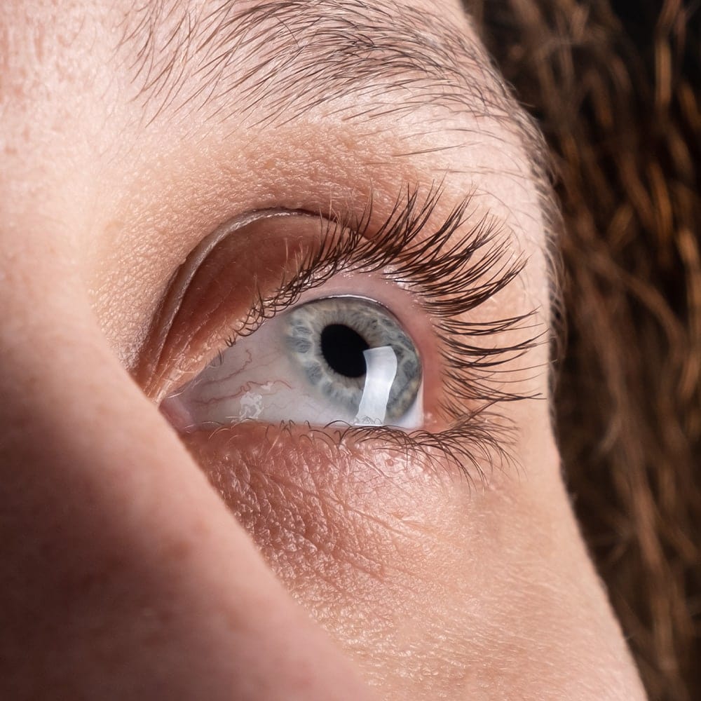 keratocone traitement dr nathalie butel chirurgien ophtalmologue specialiste chirurgie refractive cataracte oculoplastique paris keratocone traitement dr nathalie butel chirurgien ophtalmologue specialiste chirurgie refractive cataracte oculoplastique paris