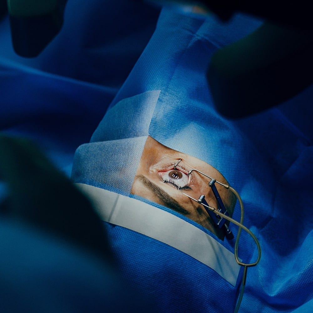 laser operation pkr dr nathalie butel chirurgien ophtalmologue specialiste chirurgie refractive cataracte oculoplasticien paris laser operation pkr dr nathalie butel chirurgien ophtalmologue specialiste chirurgie refractive cataracte oculoplasticien paris