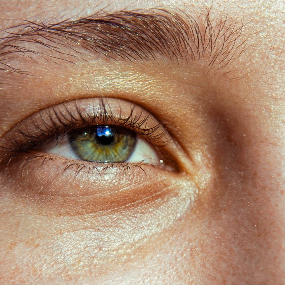 operation astigmatisme traitement dr nathalie butel chirurgien ophtalmologue specialiste chirurgie refractive cataracte oculoplastique paris